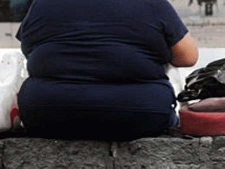 Cómo saber si tiene obesidad mórbida y como influye sobre su salud obesidad mórbida