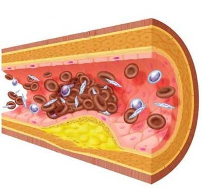 Cómo reducir el colesterol a través de la alimentación