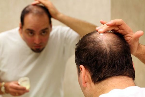 Suplementos nutricionales para el crecimiento del cabello